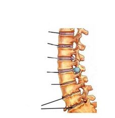 estágios de desenvolvimento da osteocondrose