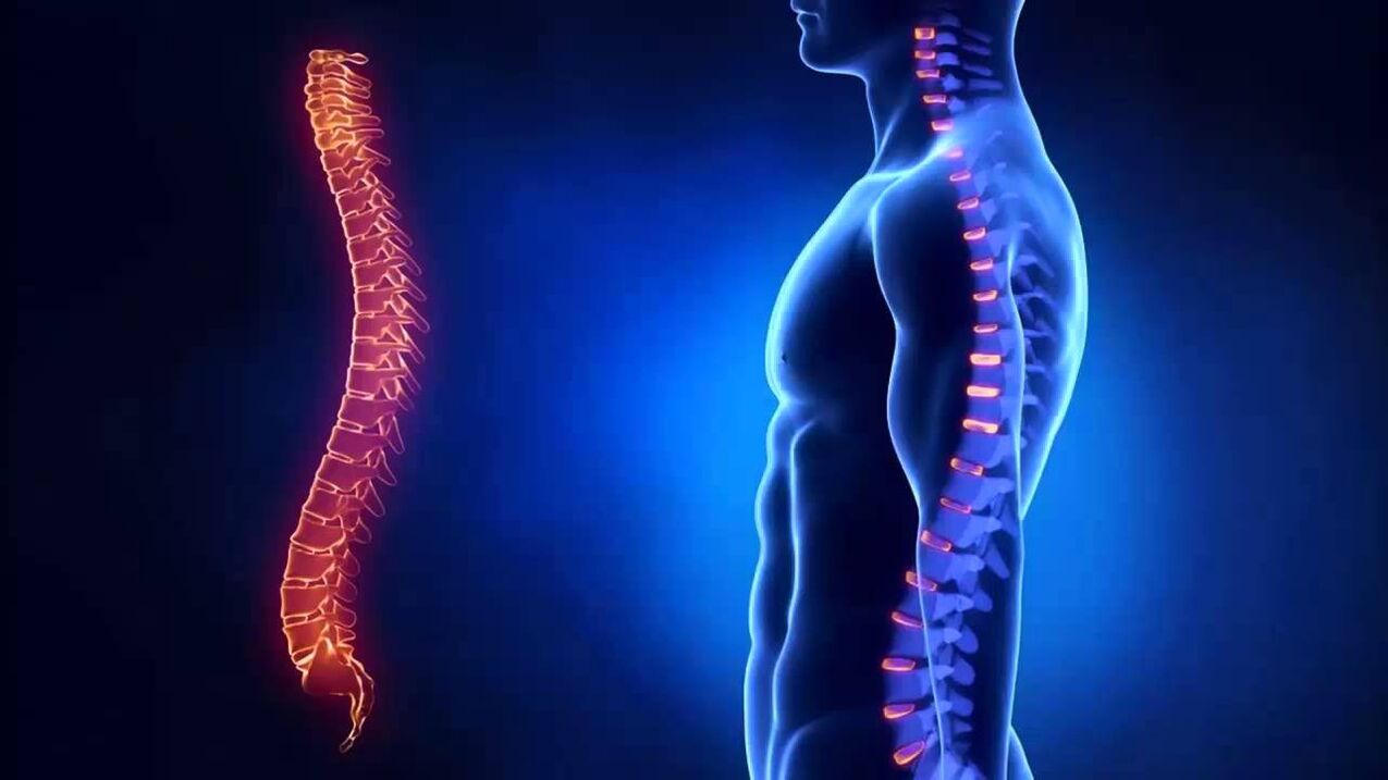 A osteocondrose é classificada de acordo com as partes da coluna onde a doença se desenvolve.